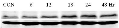western blot(sh)(yn)Y(ji)